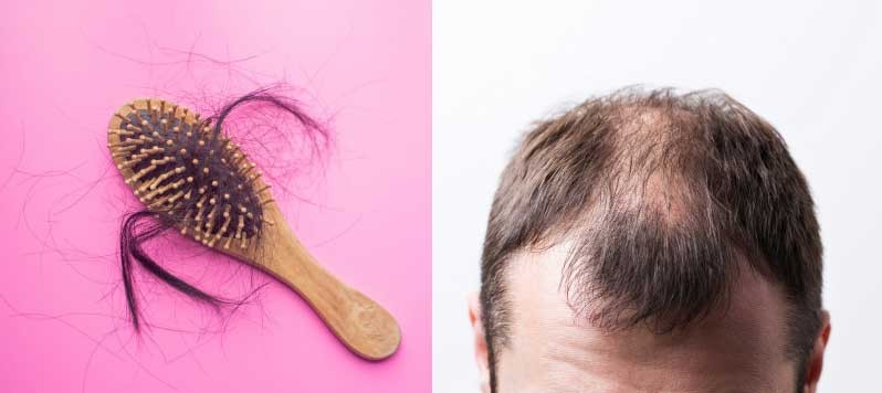 Stam Plus Linea alopecia diradamento